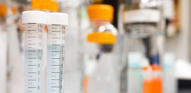 laboratory tests being performed